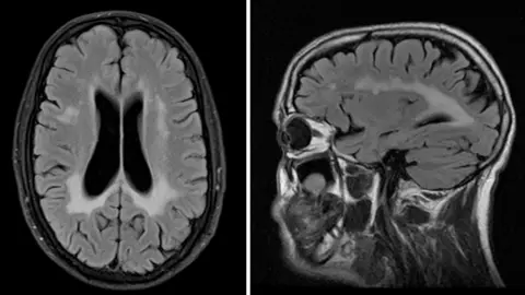 Michael Conway MRI scan