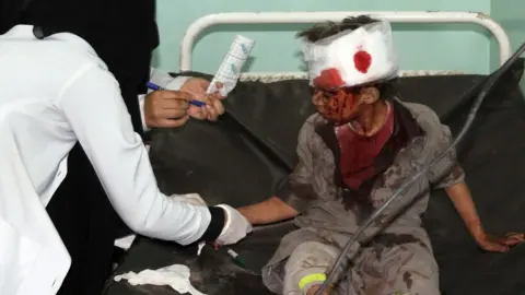 AFP File photo showing a Yemeni boy being treated at a hospital after a Saudi-led coalition air strike on a bus carrying children in rebel-held Saada province on 9 August 2018