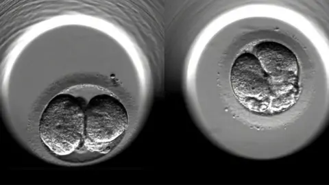 Getty Images The cell-division of two fertilised human embryos during the first 24 hours of embryonic development following IVF treatment