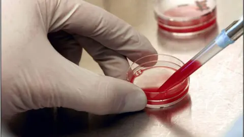 Getty Images blood tests