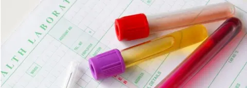 Thinkstock Drug tests generic pic