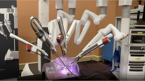 Tom Percival/BBC The da Vinci XI surgical robot with 'octopus arms'