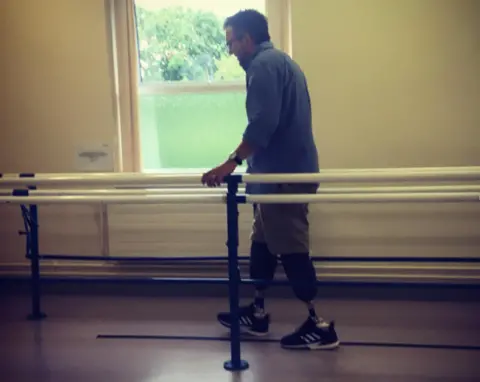 Instagram / bionicsurgeon Neil learning to walk