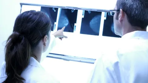 AJ PHOTO/HOP AMERICAIN/SCIENCE PHOTO LIBRARY Docytors looking at mammograms