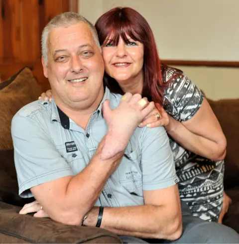 Shutterstock Hand transplant recipient Mark Cahill seen at home with his Wife Sylvia