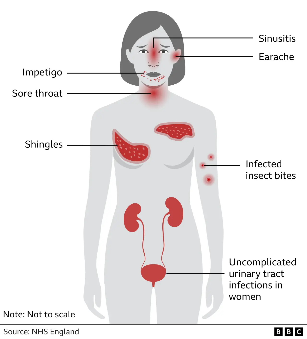 Graphic illustrating seven common ailments that can now be assessed at chemists