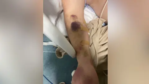 Brett Sutton Brett Sutton in hospital