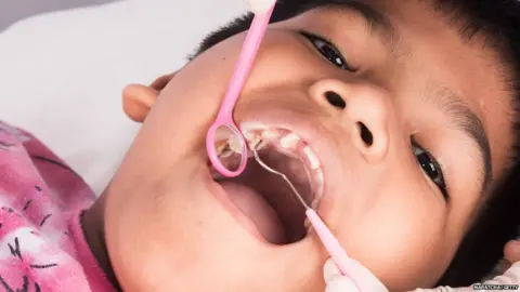 napatcha/Getty Boy having dental check-up