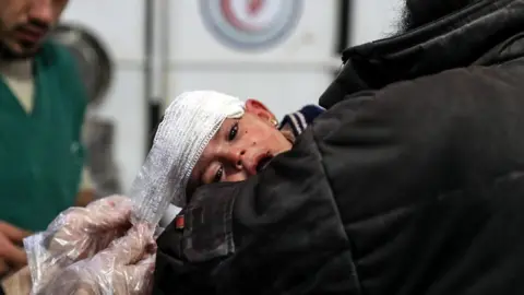 EPA An injured nine-month-old girl receives medical attention at a field hospital in rebel-held Douma, Syria (26 November 2017)