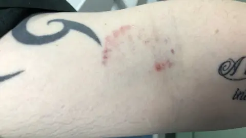 West Midlands Ambulance The injury