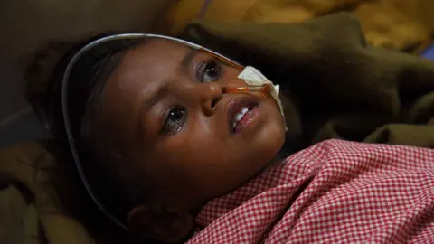 An Indian child patient receives medical treament for Japanese Encephalitis at Gaya Medical College in Gaya on September 14, 2015. Encephalitis are common every year in India, especially during the monsoon season, and claim hundreds of lives.