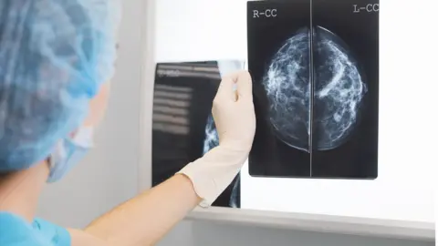 Getty Images doctor in surgery outfit is holding a mammogram in front of x-ray illuminator