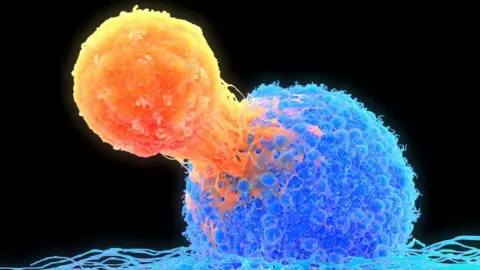 Getty Images T-cell versus cancer