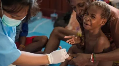 Getty Images Nurse treats young boy in Papua.