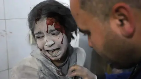 AFP A Syrian girl receives treatment in the rebel-held enclave of Eastern Ghouta on March 7, 2018.