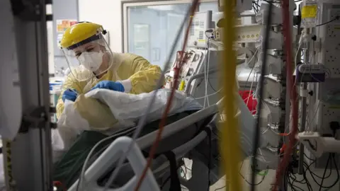 PA Media Intensive care unit