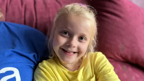 Shaun Whitmore/BBC Butterfly skin girl Charlie-Mai