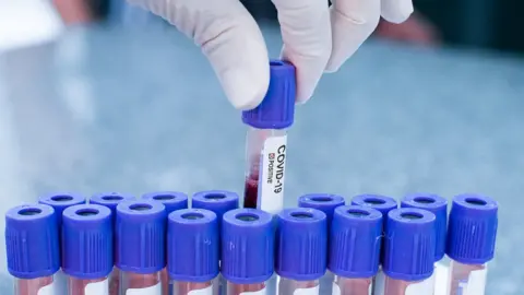 Getty Images surgical gloved hand holding blood sample in tube