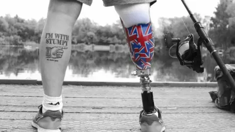 UNIVERSITY OF ESSEX Fisherman with prosthetic leg next to a lake