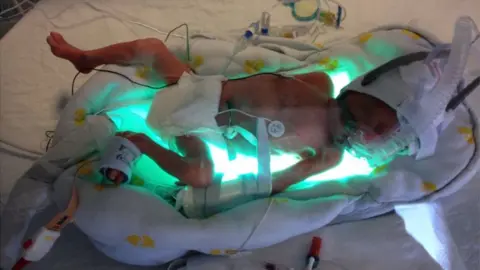 Suzanne Ruart Aiden in the neonatal unit