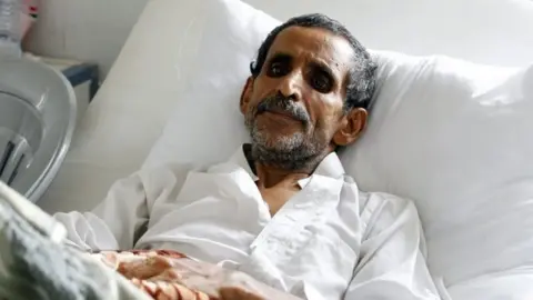 EPA A cholera-infected Yemeni receives treatment at a hospital amid a serious cholera outbreak in Sanaa, Yemen (22 June 2017)