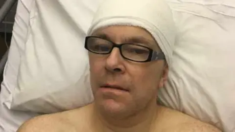 Man in hospital bed with glasses on and a thick bandage round his head