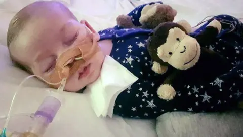 PA Charlie Gard