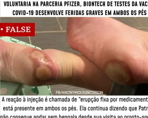 Facebook Post in Portuguese about feet