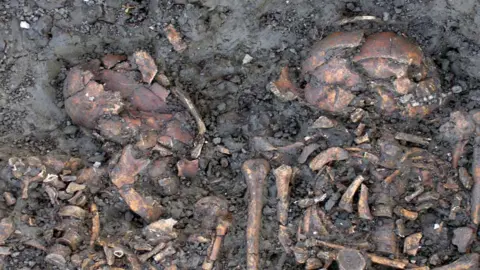 Late Roman skulls, Cheddington