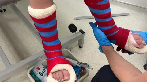 Family photo Imogen being fitted with casts