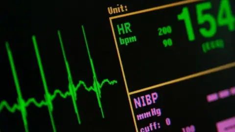 Thinkstock Heart rate on monitor