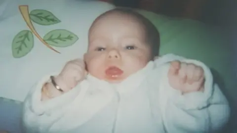 Taylor McTaggart Taylor McTaggart when she was baby before the amputations