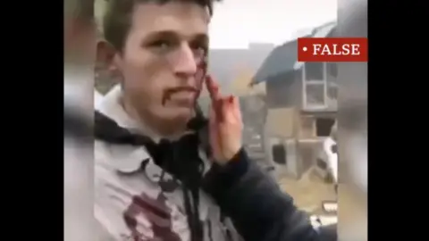 Facebook Man having blood make up applied to him on set of a film