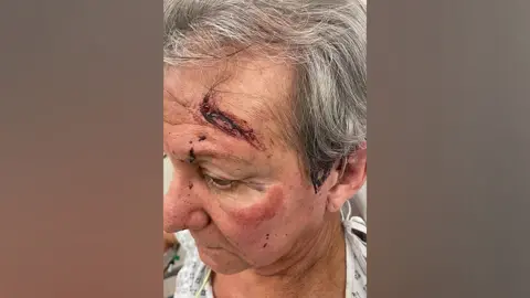 Ian Towning Mr Towning was treated at hospital for his injuries