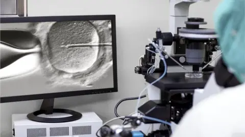 Getty Images IVF being done on a microscope