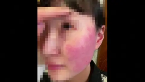 Reuters Blurred image of shop worker with swollen red face
