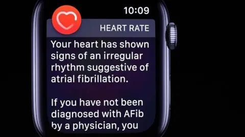 AFP via Getty Images Apple smart watch heart alert