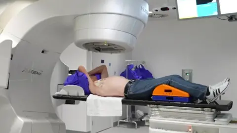 A man lying on a bed with with his top off and his arms above his head and a radiotherapy machine above him