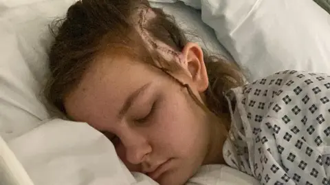 Tilly, lies on a hospital bed sleeping. There is a distinctive scar with stitching on the left side of her head.