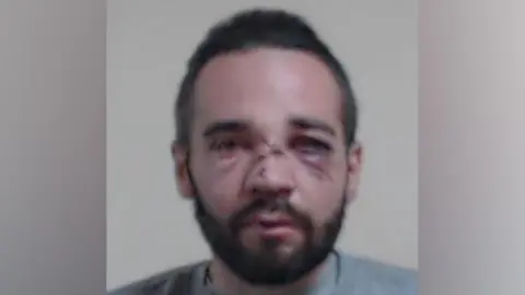 Police Scotland MacDonald is pictured in a police mugshot. he has injuries to his face