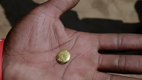 A tiny gold ingot sits on the on the palm of a hand in close-up. A wrist band saying "World Aids day" is also visible.