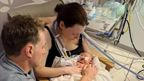 Emily Brazier sits and holds baby Liliwen in her arms, the baby wears breathing aid. The father, Rhodri Thomas, has his hand on the baby and looks down at her. 