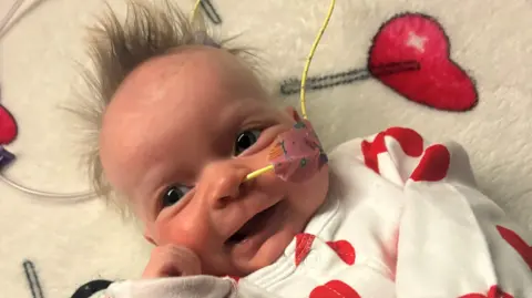 A young baby wearing a white babygrow with red hearts on it smiles at the camera. The baby has a yellow hospital tube coming out of her nose and has wispy brown hair. 