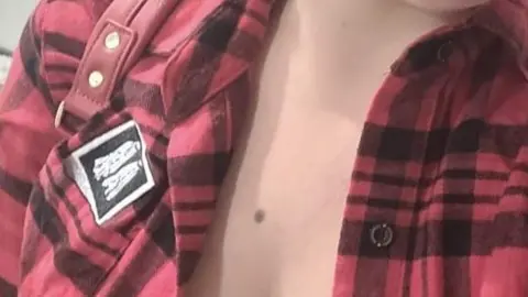 Chelsea Rees Mole on Chelsea's chest