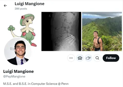 X A series of pictures across the top of Mangione's X account, showing an animated character, a picture of Mangione smiling, a picture of Mangione with his shirt off in front of a mountain and an x-ray showing four metal pins in a spine