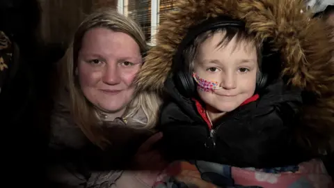 A woman with blonde hair sits next to a young girl with short brown hair and a medical tube taped across her face. 