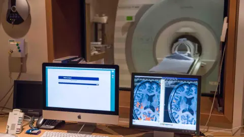 University of Oxford An MRI scanner and two computer screens showing brain scans