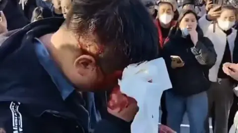 Protester wiping his bloodied head with tissue paper at Pucheng in China. Grab from video on X