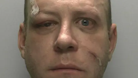 Devon and Cornwall Police A mugshot of Guy Pottle. His left eye is swollen and he has cuts to his face.