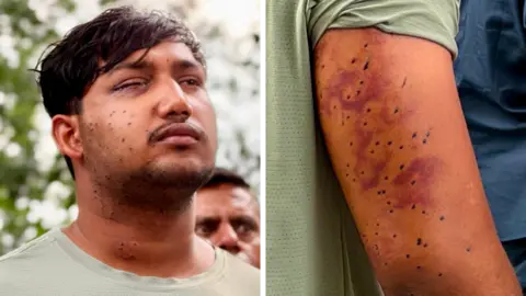 Sahil Lochab's face and right arm which show the pellet gun wounds on his body
